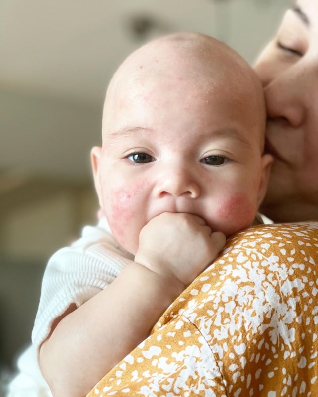Bayi Mona Ratuliu alami dermatitis atopik Foto: Instagram/@monaratuliu