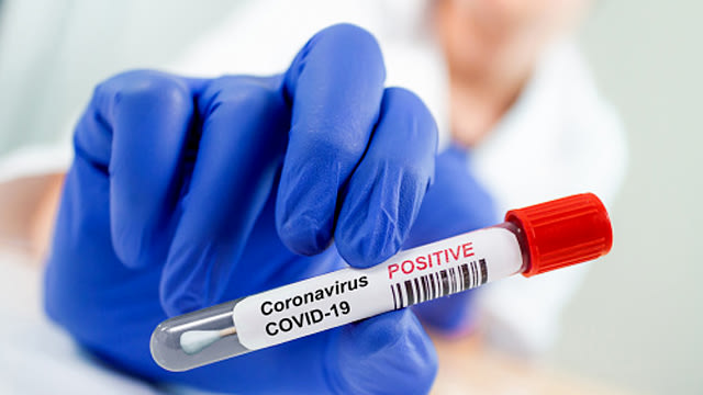 Ilustrasi Positif Corona (Foto: ShutterStock)