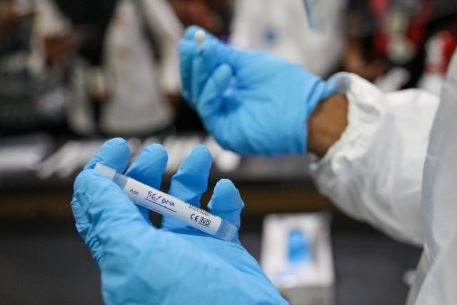 Pengambilan sampel swab di Aceh, Juni 2020. Foto: Suparta/acehkini 