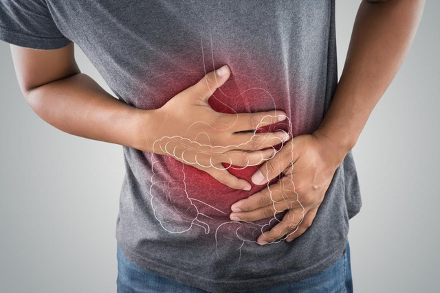 Kanker usus besar adalah jenis kanker yang menyerang usus besar atau bagian akhir dari saluran pencernaan. Foto: Shutterstock