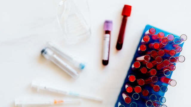 Ilustrasi (Foto: pexels.com)