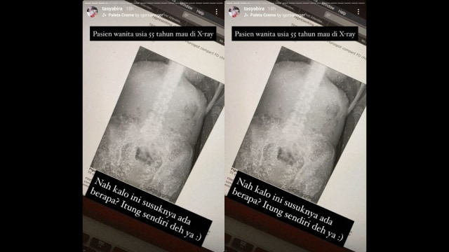 Dok. Instagram/@tasyabira