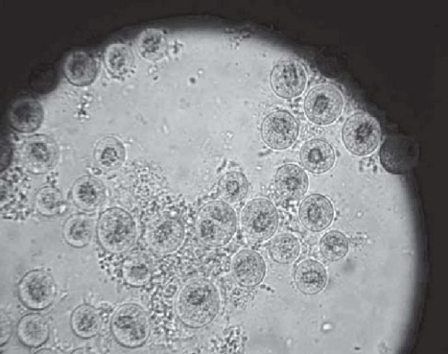 Ilustrasi Amoeba Naegleria fowleri. Foto: Lata R. Chandel via Research Gate web