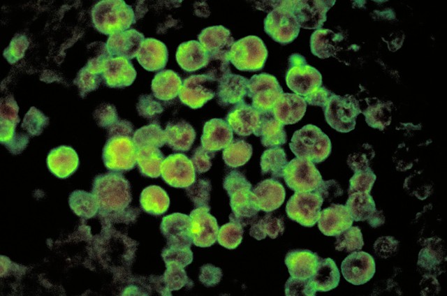 Ilustrasi amuba Naegleria fowleri. Foto: CDC via Wikimedia Commons