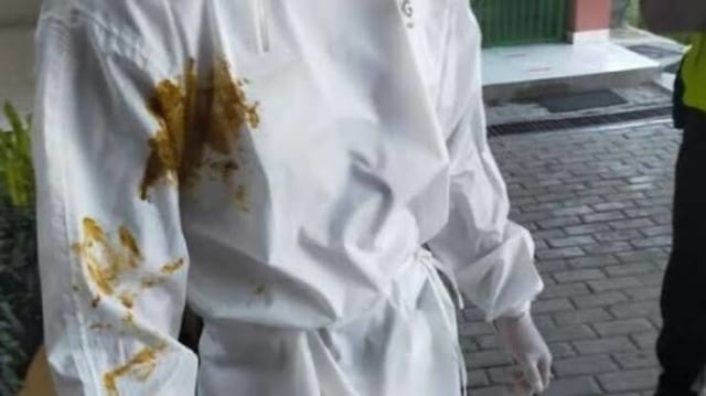 APD nakes yang dilempari istri pasien COVID-19 dengan kotoran manusia. Pelaku akhirnya ditetapkan sebagai tersangka.﻿