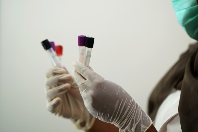 Ilustrasi pengujian hasil swab test. Foto: Dok. Pixabay