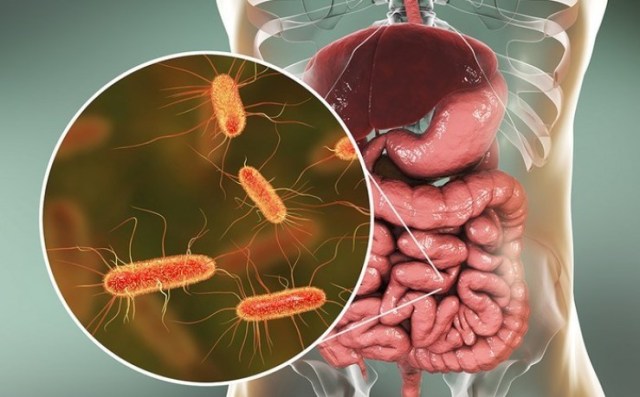 Bakteri E.Coli, Foto: Dok. Among Guru