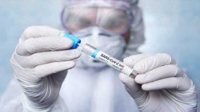 Ilustrasi: swab test COVID-19 (foto: getty image)
