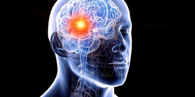 The Problem of Visual Agnosia