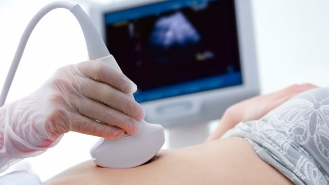Ilustrasi USG ibu hamil. (Foto: Thinkstock)