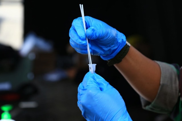 Ilustrasi PCR antigen. Foto: Aditia Noviansyah/kumparan