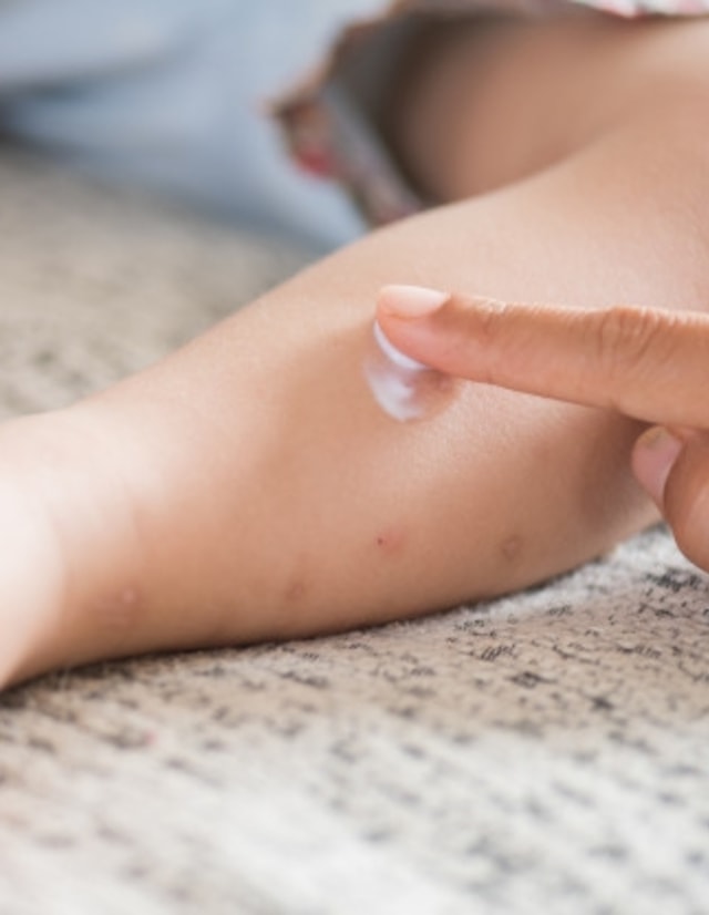 Bolehkah Anak Mandi saat Terkena Campak? Foto: Freepik