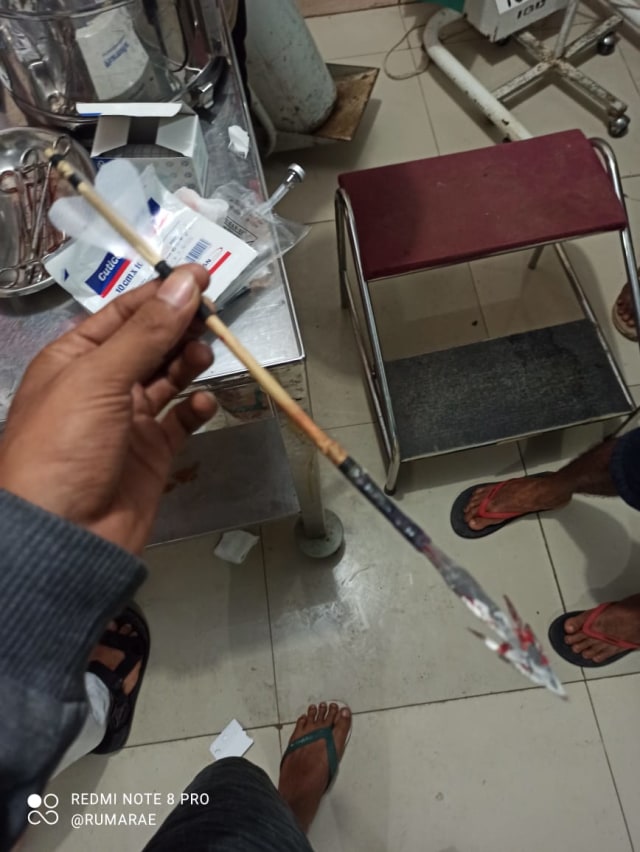 Remaja di Dompu, NTB, menjadi korban pemanahan. Foto: Dok. Istimewa