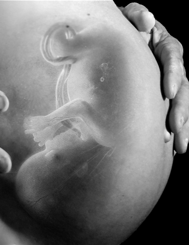 Perkembangan Janin Usia 35 Minggu, Ibu Hamil Perlu Tahu! Foto: Freepik