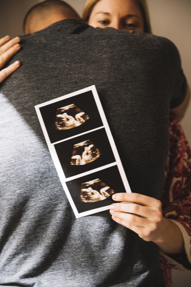 Kapan Janin Dapat Terlihat saat Pemeriksaan USG? Foto: Freepik