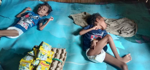 Kondisi terkini Alfaris Yosin (13), Rivaldus Rival (11), dua bocah penderita gizi buruk aku dan Hidrosefalus. Foto : Albert Aquinaldo