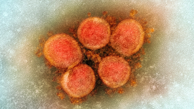 Penampakan varian Corona. Foto: NIAID 