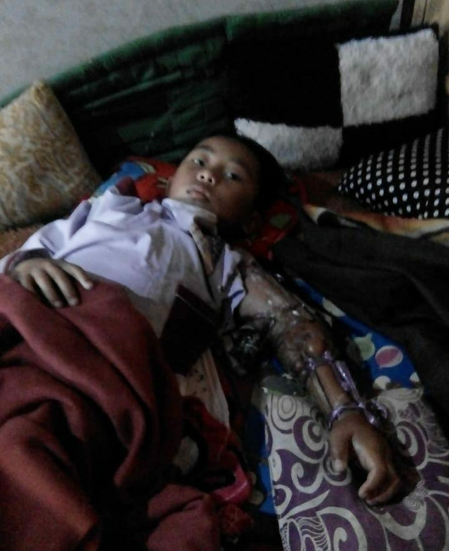 Maulana saat terbaring lemas di rumahnya | Foto: Istimewa