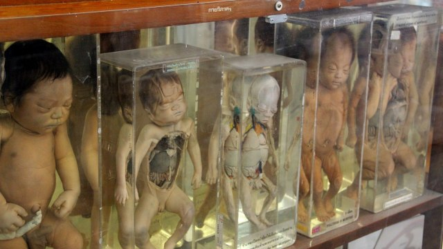 Mengunjungi Museum of Death di Thailand yang Berisi Jenazah Manusia | kumparan.com