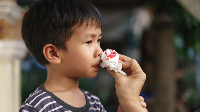 Ilustrasi anak mimisan. Foto: Shutterstock