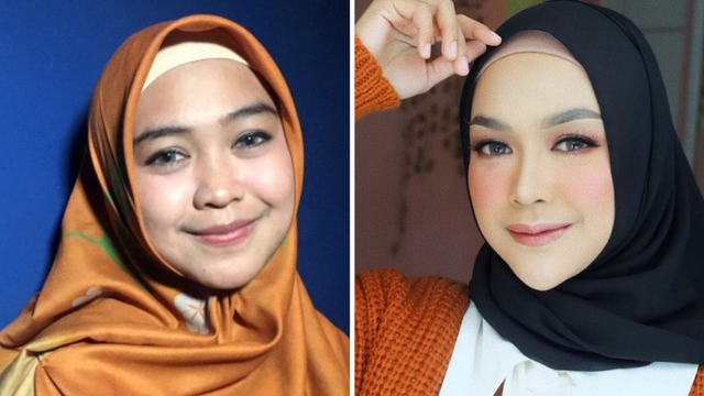 Potret befor-after artis Ria Ricis