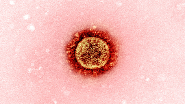 Penampakan varian Corona B117 dari mikroskop elektron. Foto: NIAID