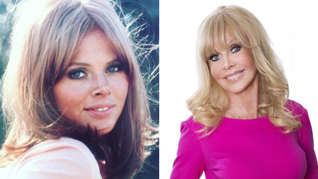 Cerita Mantan 'Bond Girl' yang Kariernya Hancur Karena Filler Bibir. Foto: dok. Instagram@brittekland