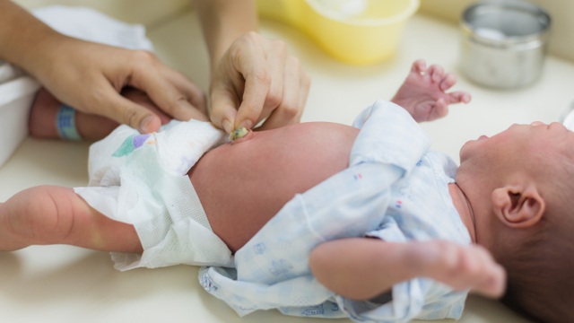 Ilustrasi menggantikan popok bayi baru lahir. Foto: Shutter Stock