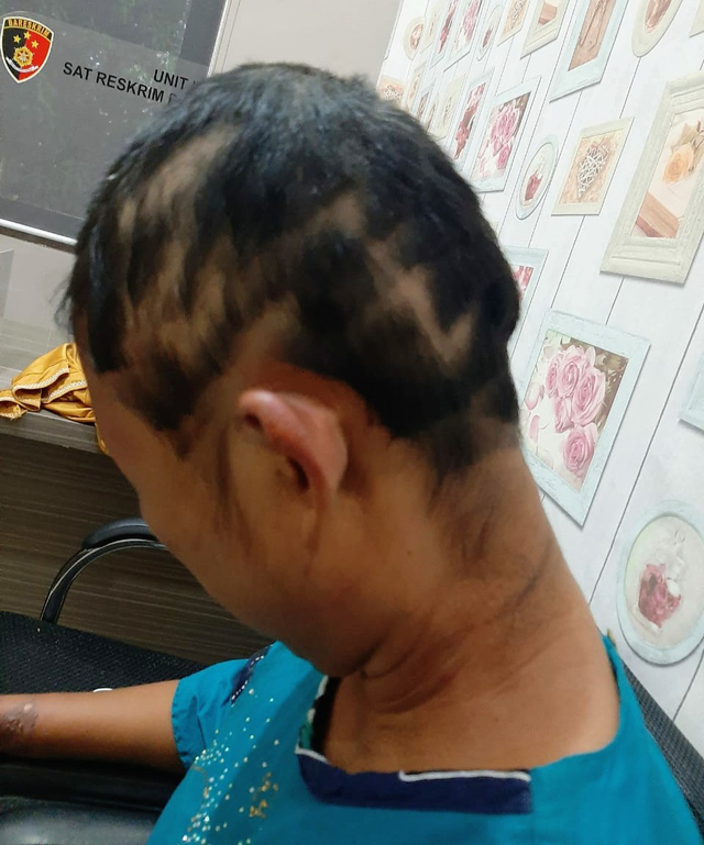 RE, korban penganiayaan suaminya di Banyuasin, Sumsel. (foto: istimewa)