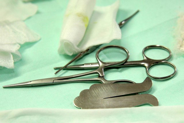 Ilustrasi alat untuk sunat cincin. Foto: Shutterstock