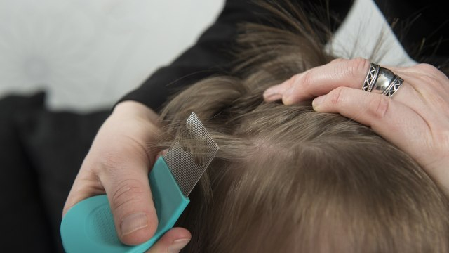 Ilustrasi cara menghilangkan kutu rambut. (Dok. Thinkstock)