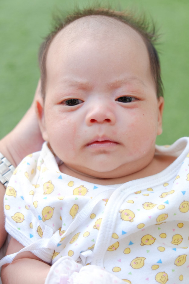 Kenapa Bentuk Kepala Bayi Lonjong ke Atas? Foto: Freepik