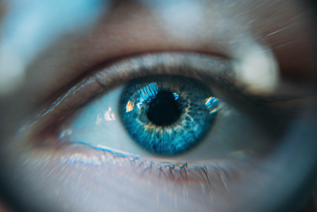 Ilustrasi Arti Kedutan Mata Kanan Atas, Berdasarkan Posisi dan Cara Mengatasinya Foto: Unsplash