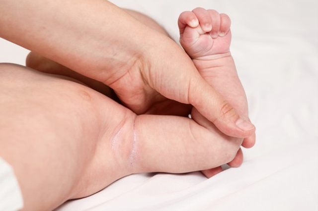 llustrasi Bagian Tubuh Bayi Rentan Biang Keringat. Foto: Freepik