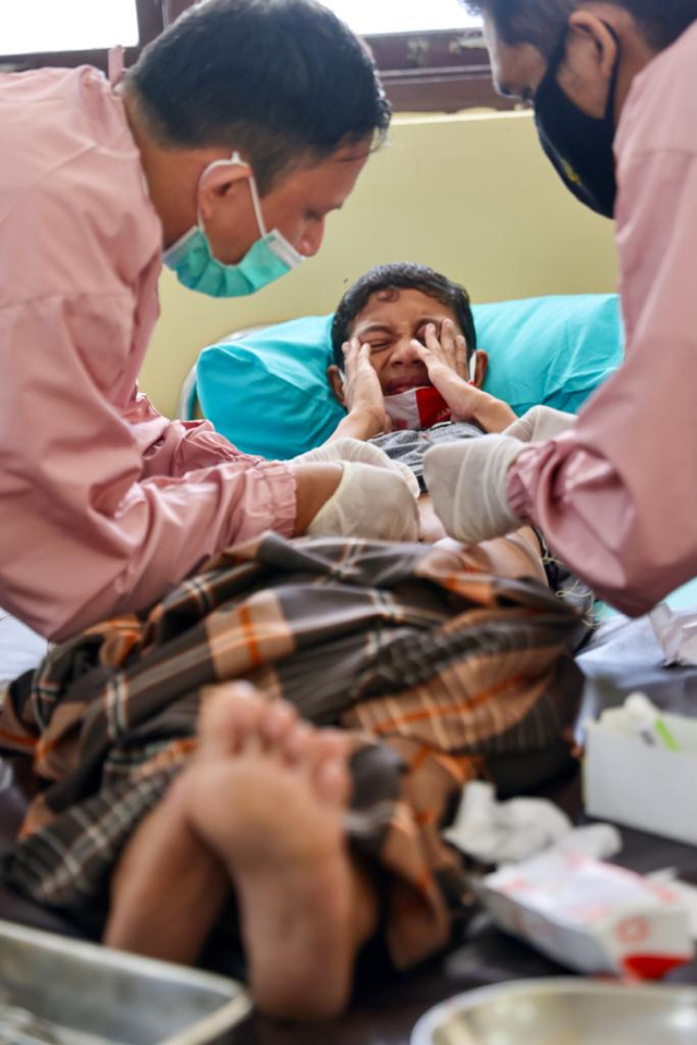 Ekspresi anak saat dikhitan. Foto: Suparta/acehkini