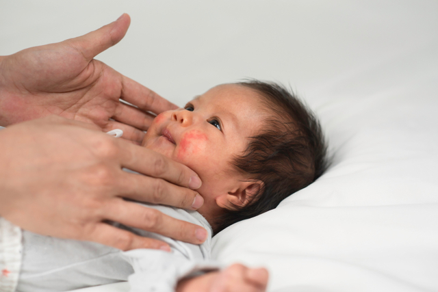 Kulit sensitif bayi baru lahir. Foto: Shutterstock