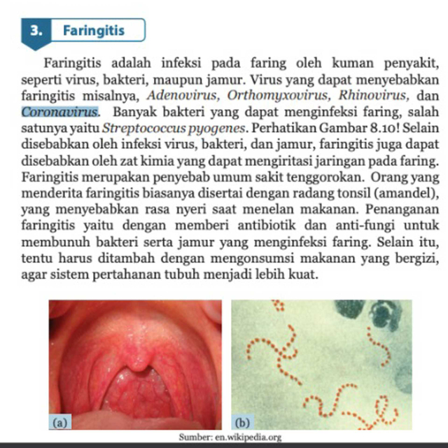 Coronavirus yang tertulis dalam Buku IPA Kelas 8 Semester 2. Foto: Dok. Istimewa