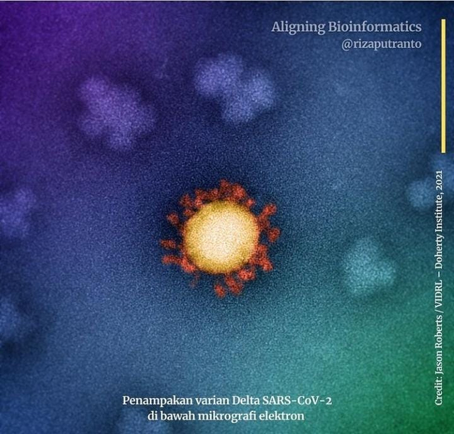 Penampakan varian Corona Delta terungkap. Foto: Dok. Jason Roberts/VIDRL - Doherty Institute, 2021
