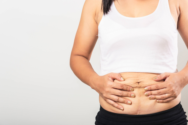 Ilustrasi ibu perdarahan usai melahirkan. Foto: Shutter Stock