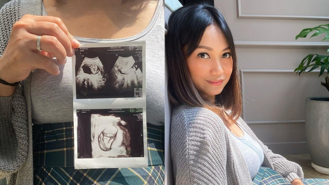 Hamil Jelang Usia 43 Tahun seperti Nola B3, Apa Risikonya? Foto: Instagram/@riafinola