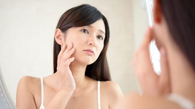 Ilustrasi masalah kulit wajah pada perempuan. Foto: Shutterstock