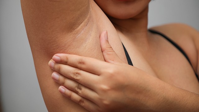 Ilustrasi ketiak hitam. Foto: Shutter Stock