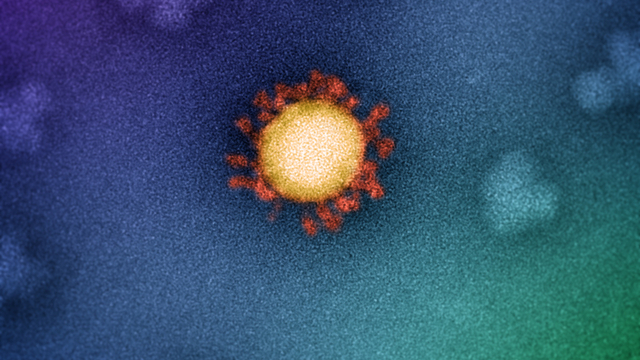 Foto asli corona varian Delta. Foto: Jason Roberts/The Doherty Institute