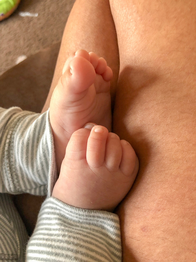 Ilustrasi overlapping toes atau jari kaki bayi bertumpuk. 
 Foto: Shutter Stock
