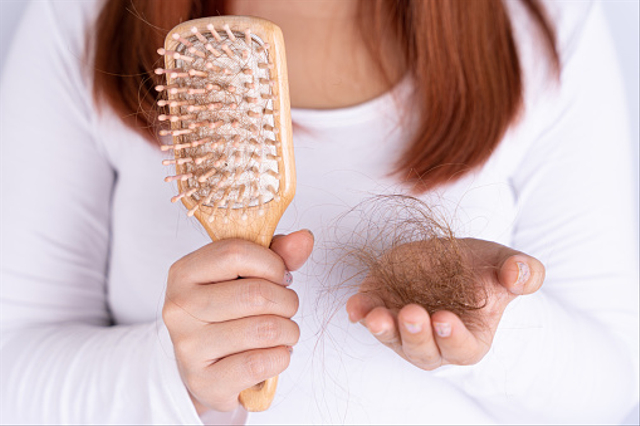 Ilustrasi rambut rontok, Sumber: pixabay
