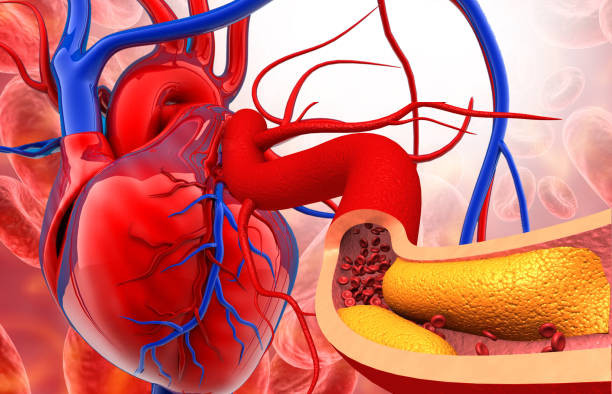 Ilustrasi sistem peredaran darah manusia. Foto: iStock