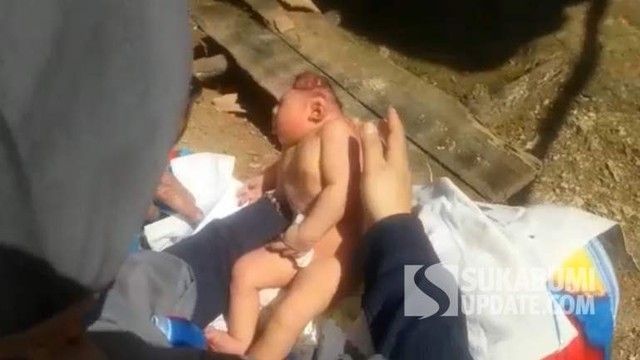 Neng Syifa, anak buruh batur kapur di Jampangtengah, Kabupaten Sukabumi, yang mengalami anensefali. | Istimewa