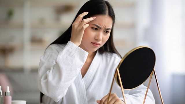 Ilustrasi mengatasi kerutan di dahi. Foto: Shutter Stock