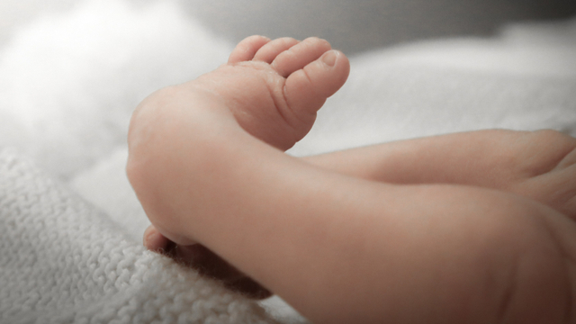 Ilustrasi kaki bayi pengkor. Foto: Shutter Stock