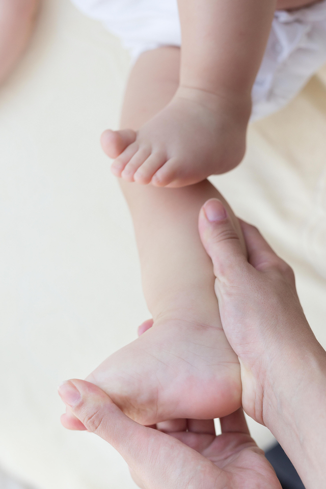 Ilustrasi kaki bayi pengkor. Foto: Shutter Stock